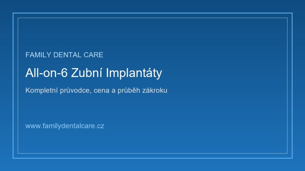 All on 6 cena: Kompletní přehled nákladů, výhod a průběhu zubní implantace 1 All on 6 cena: Kompletní přehled nákladů, výhod a průběhu zubní implantace