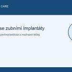 Problémy se zubními implantáty: Příčiny, příznaky, komplikace a jejich řešení 3 Problémy se zubními implantáty: Příčiny, příznaky, komplikace a jejich řešení