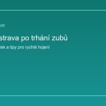 Metoda All-on-4 ceník: Kompletní průvodce cenami, průběhem a výhodami kasovita_strava_featured