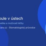 tvrda_boule_v_ustech_featured